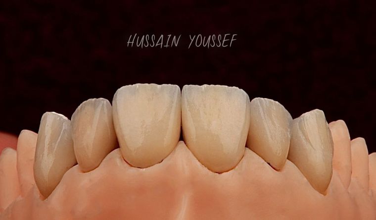 Arbeit von Hussain Youssef