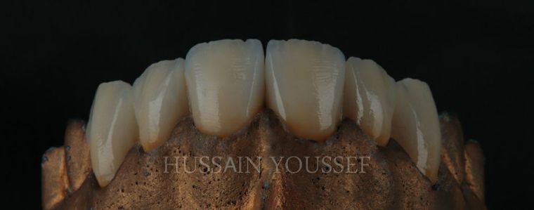 Arbeit von Hussain Youssef