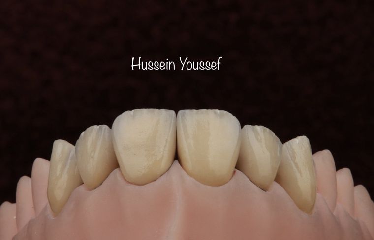 Arbeit von Hussain Youssef